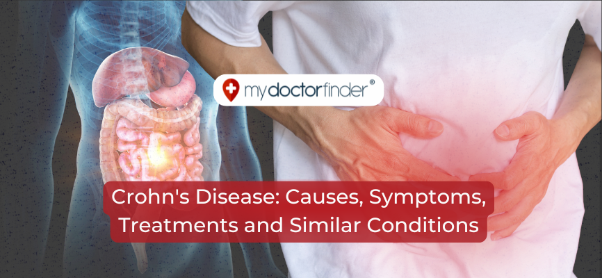 Crohn's Disease: Causes, Symptoms, Treatments and Similar Conditions